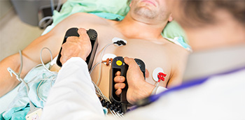 Infarto agudo de miocardio: Algoritmos simplificados