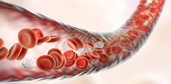 Casos clínicos interactivos – Hemofilia