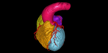 TC coronario en urgencias