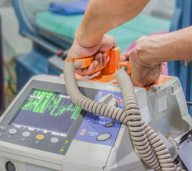 Fibrilación Auricular