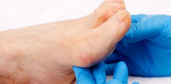 Tratamiento de rehabilitación del SDRC