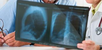 Hipertensión pulmonar