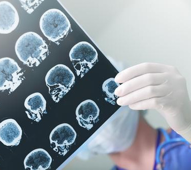 El informe radiológico estructurado