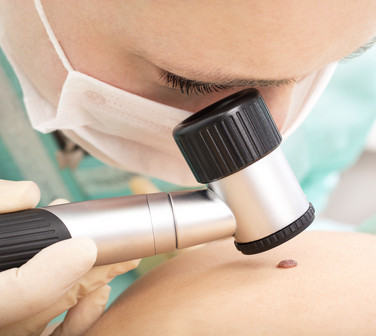 Melanoma localmente avanzado