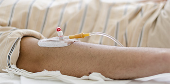 Plan de cuidados para paciente portador PICC