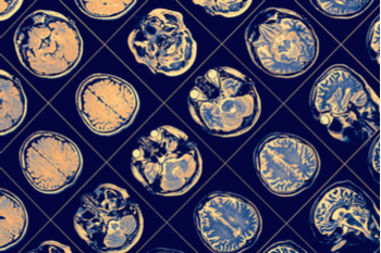 Instrumentos en esquizofrenia