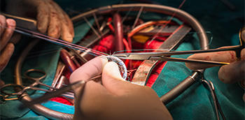 Diagnóstico de la estenosis valvular aórtica