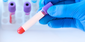 Marcadores tumorales