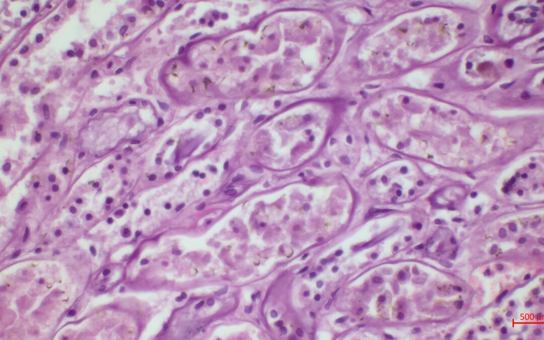 Anatomía Patológica: Conceptos, Tinciones y Metodología LEAN