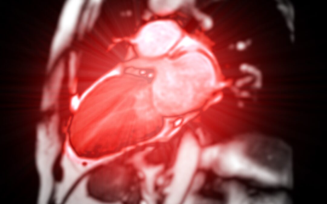 Imagen Cardiotorácica (Interpretación de radiografías de tórax)